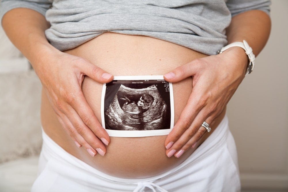 Ultrasonido de control de embarazo en Médica Fusión Humana