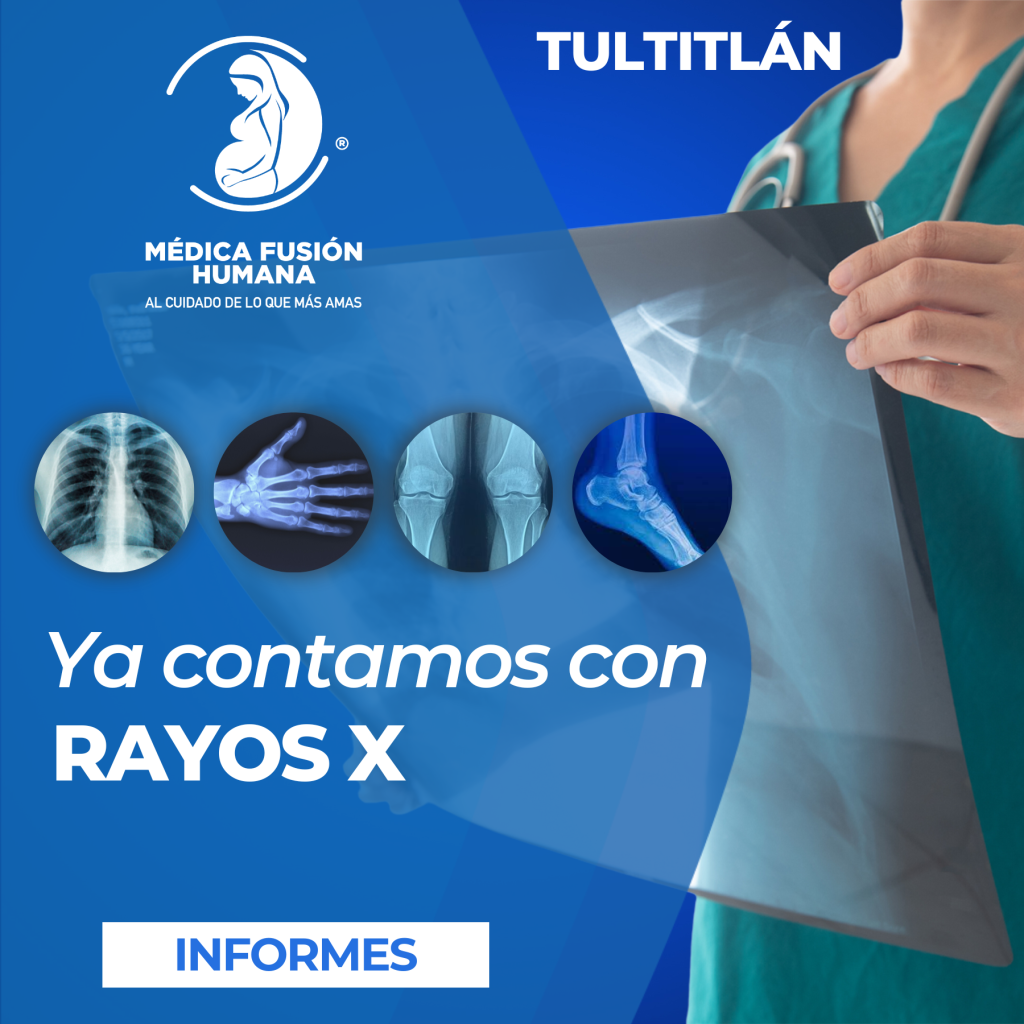 Rayos X MFH Tultitlán